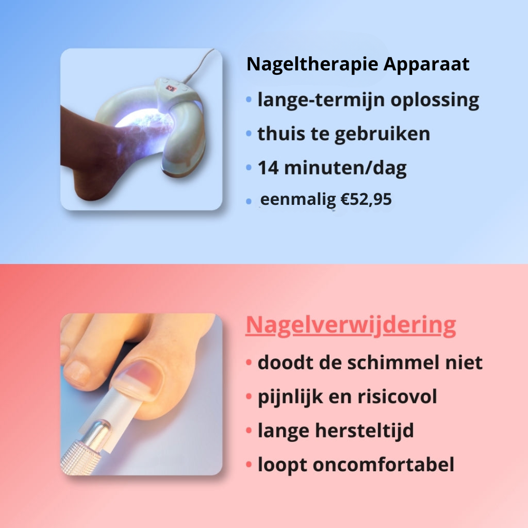 Nageltherapie Apparaat - Laserbehandeling Tegen Schimmelnagels - Veilig en Pijnloos Thuisgebruik